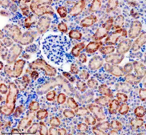 IHC analysis of PDGFD using anti-PDGFD antibody (A01875-2)