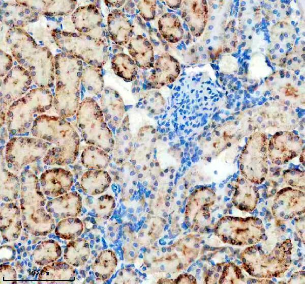a01875 2 pdgfd primary antibodies ihc testing 3