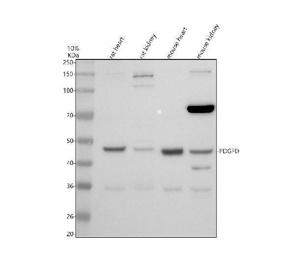 Western blot analysis of PDGFD using anti-PDGFD antibody (A01875-2)
