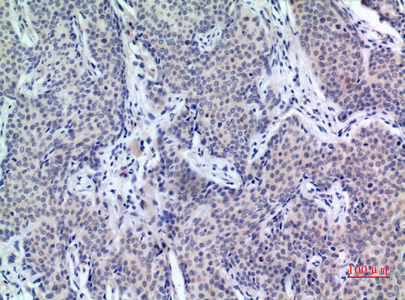 a01875 pdgfd primary antibodies ihc testing 1