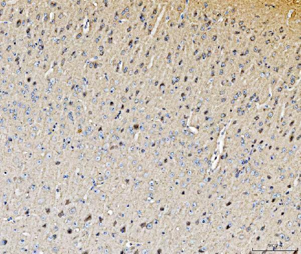  IHC analysis of Histidine Decarboxylase/HDC using anti-Histidine Decarboxylase/HDC antibody (A01876-1)