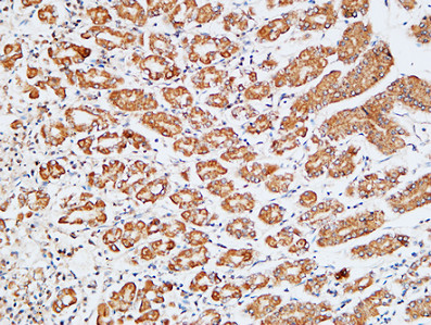 a01876 hdc primary antibodies ihc testing 1