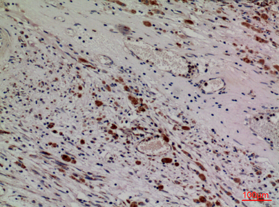 a01876 hdc primary antibodies ihc testing 4