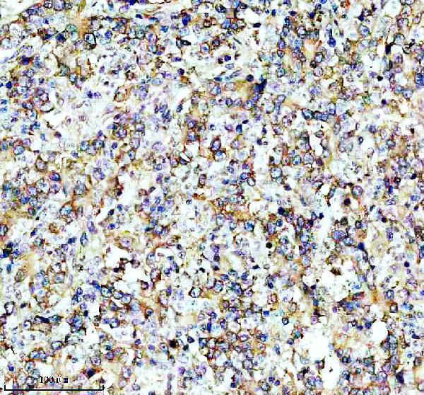 IHC analysis of PABP using anti-PABP antibody (A01877-1)