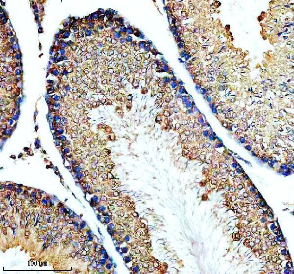 IHC analysis of PABP using anti-PABP antibody (A01877-1)
