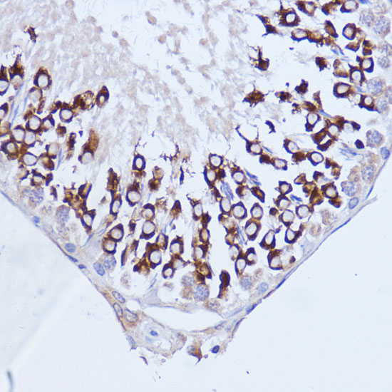 a01877 pabpc1 primary antiboties ihc testing 2