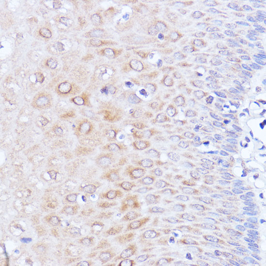 a01877 pabpc1 primary antiboties ihc testing 3