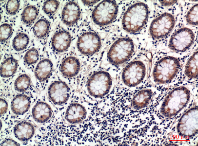 Immunohistochemical analysis of paraffin-embedded human-uterus, antibody was diluted at 1:100