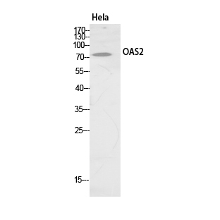 Western Blot analysis of HeLa cells using OAS2 Polyclonal Antibody