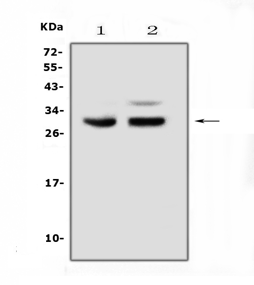  Western blot analysis of PDCD10 using anti-PDCD10 antibody (A01879-1)