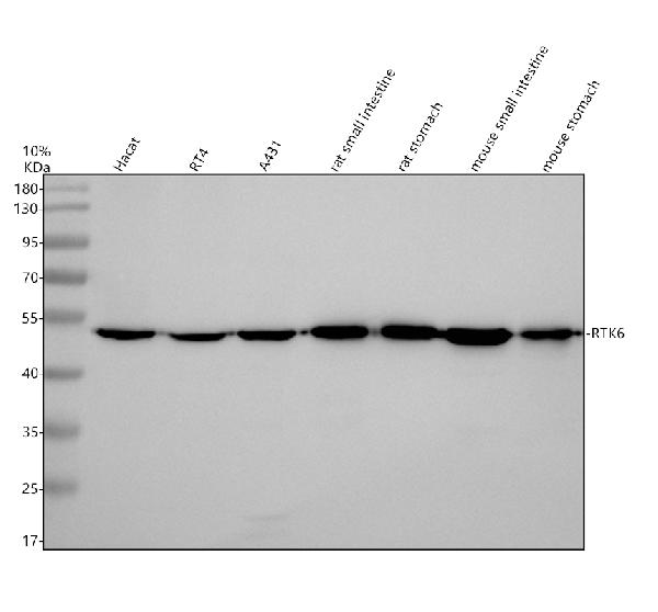 Western blot analysis of PTK6 using anti-PTK6 antibody (A01881-1)