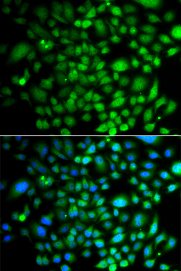 Immunofluorescence analysis of A549 cells using PTK6 antibody 