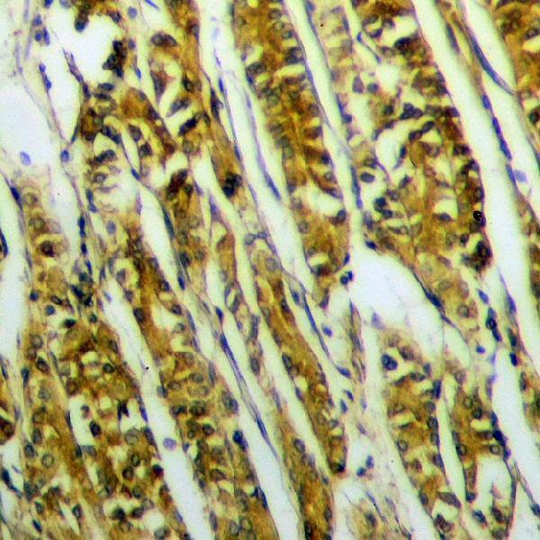 a01881y342 ptk6 primary antiboties ihc testing 2