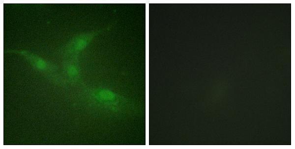 a01881y447 ptk6 primary antibodies if testing 1