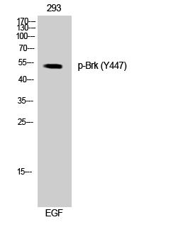 a01881y447 ptk6 primary antibodies wb testing 2