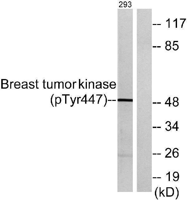 a01881y447 ptk6 primary antibodies wb testing 3