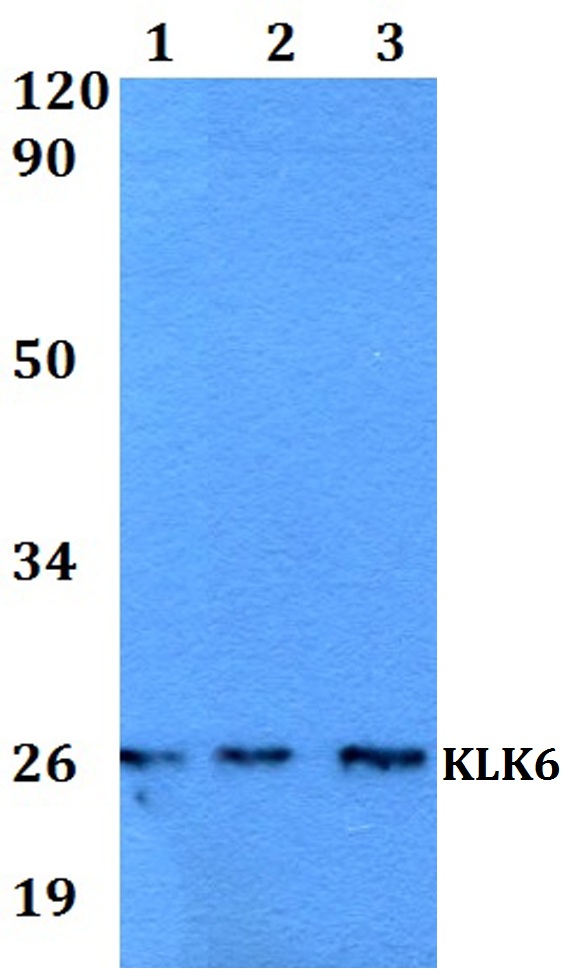 Western blot (WB) analysis of KLK6 polyclonal antibody at 1:500 dilution
Lane1:HEK293T whole cell lysate
Lane2:sp2/0 whole cell lysate 
Lane3:PC12 whole cell lysate 