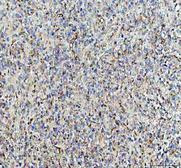 IHC analysis of NMDAR2B/GRIN2B using anti-NMDAR2B/GRIN2B antibody (A01883-2)