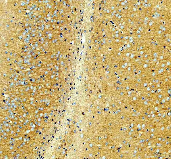 IHC analysis of NMDAR2B/GRIN2B using anti-NMDAR2B/GRIN2B antibody (A01883-2)