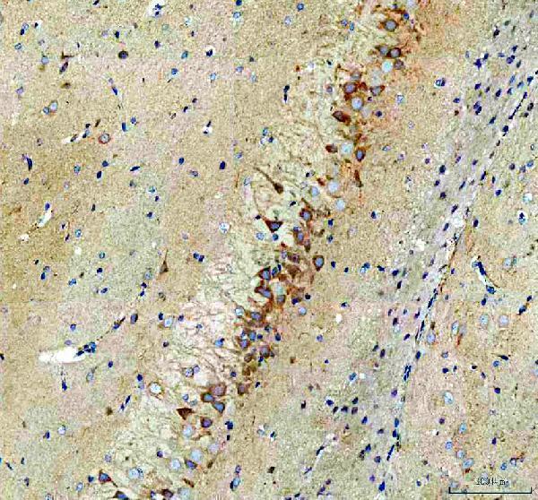 a01883 2 nmdar2b grin2b primary antibodies ihc testing 3