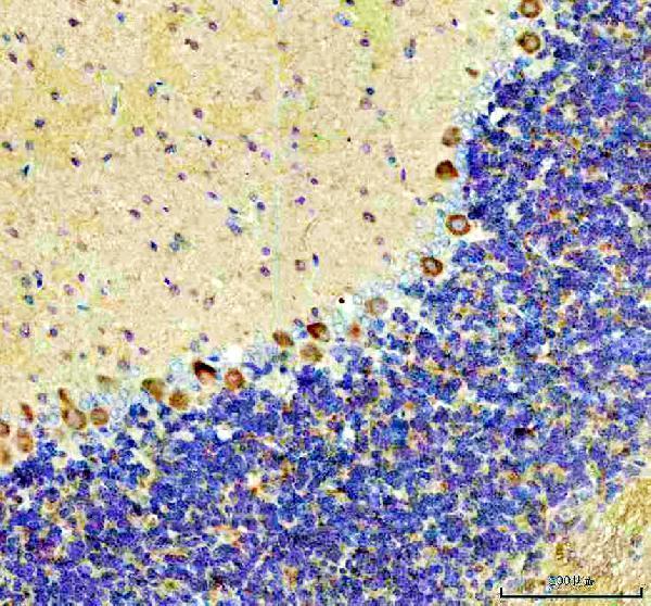 a01883 2 nmdar2b grin2b primary antibodies ihc testing 4