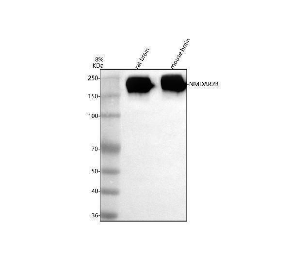 Western blot analysis of NMDAR2B/GRIN2B using anti-NMDAR2B/GRIN2B antibody (A01883-2)