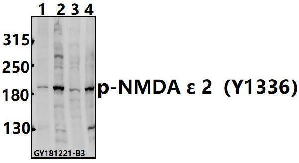 Western blot (WB) analysis of p-NMDA ε 2(Y1336) polyclonal antibody at 1:500 dilution
Lane1:U-87MG whole cell lysate(40ug)
Lane2:HEK293T whole cell lysate(40ug)
Lane3:C6 whole cell lysate(40ug)
Lane4:BV2 whole cell lysate(40ug)