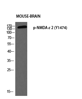 Western blot analysis of MOUSE-BRAIN using p-NMDAε2 (Y1474) antibody