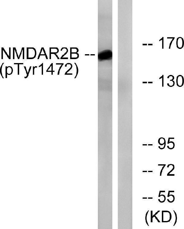 Western blot analysis of lysates from Jurkat cells treated with UV 15