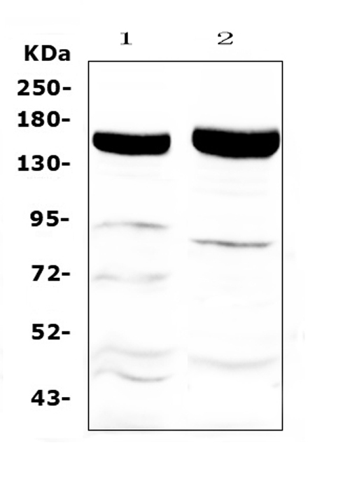 Western blot analysis of Xanthine Oxidase using anti-Xanthine Oxidase antibody (A01884). Electrophoresis was performed on a 5-20% SDS-PAGE gel at 70V (Stacking gel) / 90V (Resolving gel) for 2-3 hours. The sample well of each lane was loaded with 50ug of sample under reducing conditions. Lane 1: rat liver tissue lysate, Lane 2: mouse liver tissue lysate. After Electrophoresis, proteins were transferred to a Nitrocellulose membrane at 150mA for 50-90 minutes. Blocked the membrane with 5% Non-fat Milk/ TBS for 1.5 hour at RT. The membrane was incubated with rabbit anti-Xanthine Oxidase antigen affinity purified polyclonal antibody (Catalog # A01884) at 0.5 μg/mL overnight at 4°C, then washed with TBS-0.1%Tween 3 times with 5 minutes each and probed with a goat anti-rabbit IgG-HRP secondary antibody at a dilution of 1:10000 for 1.5 hour at RT. The signal is developed using an Enhanced Chemiluminescent detection (ECL) kit (Catalog # EK1002) with Tanon 5200 system. A specific band was detected for Xanthine Oxidase at approximately 146KD. The expected band size for Xanthine Oxidase is at 146KD.