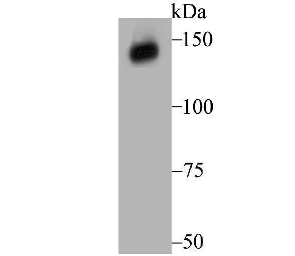 Western blot analysis of Xanthine Oxidase on human kidney tissue lysate using anti-Xanthine Oxidase antibody at 1/1,000 dilution