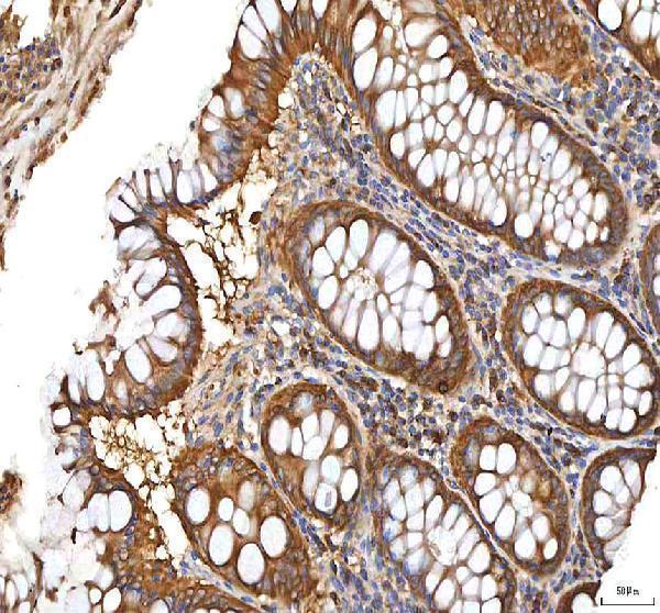  IHC analysis of XDH using anti-XDH antibody (A01884-2)