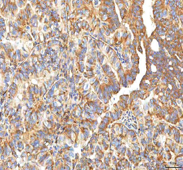 a01884 2 xdh primary antibodies ihc testing 5