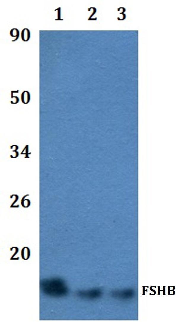 Western blot (WB) analysis of FSHB polyclonal antibody at 1:500 dilution
Lane1:Hela whole cell lysate
Lane2:Raw264