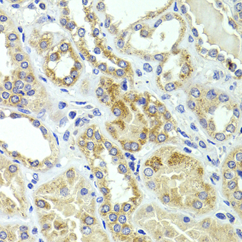 a01886 hmgcl primary antiboties ihc testing 4