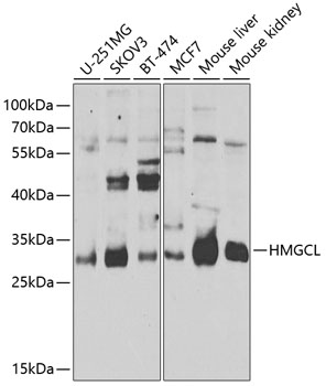 Western blot analysis of extracts of various cell lines, using HMGCL antibody  at 1:1000 dilution