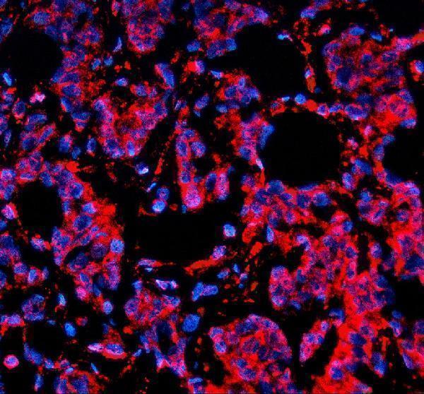 a01887 1 sorl1 primary antibodies if testing 1