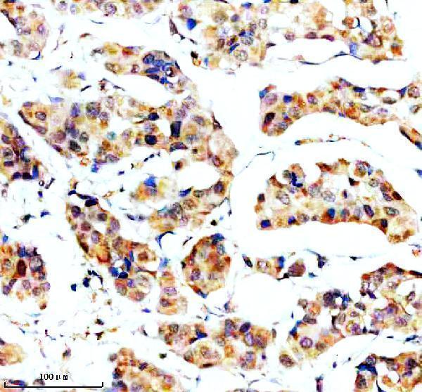 IHC analysis of SORLA/SORL1 using anti-SORLA/SORL1 antibody (A01887-1)