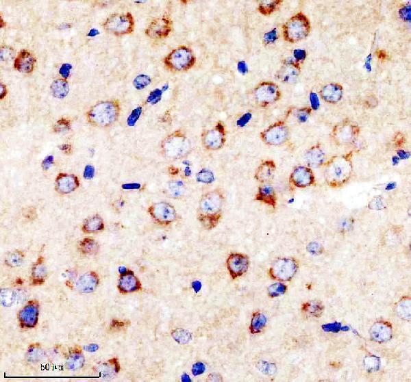 IHC analysis of SORLA/SORL1 using anti-SORLA/SORL1 antibody (A01887-1)