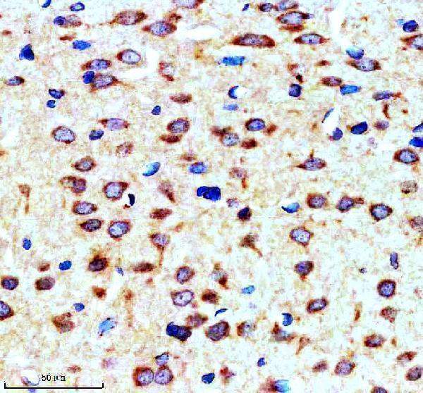 a01887 1 sorl1 primary antibodies ihc testing 3
