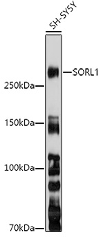 a01887 sorl1 primary antiboties wb testing 1