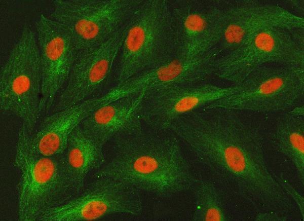 a01888 3 smarca2 primary antibodies if testing 14