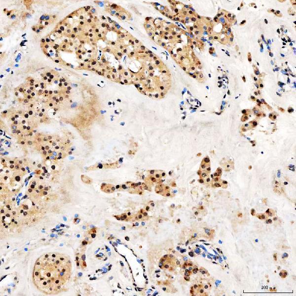 a01888 3 smarca2 primary antibodies ihc testing 10