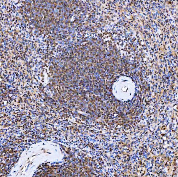 a01888 3 smarca2 primary antibodies ihc testing 11