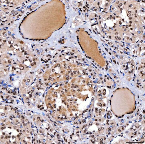 a01888 3 smarca2 primary antibodies ihc testing 12