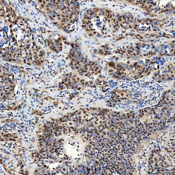 a01888 3 smarca2 primary antibodies ihc testing 13