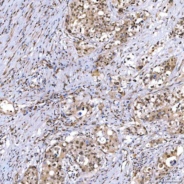  IHC analysis of SMARCA2/BRM using anti-SMARCA2/BRM antibody (A01888-3)