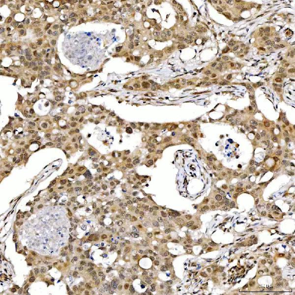  IHC analysis of SMARCA2/BRM using anti-SMARCA2/BRM antibody (A01888-3)