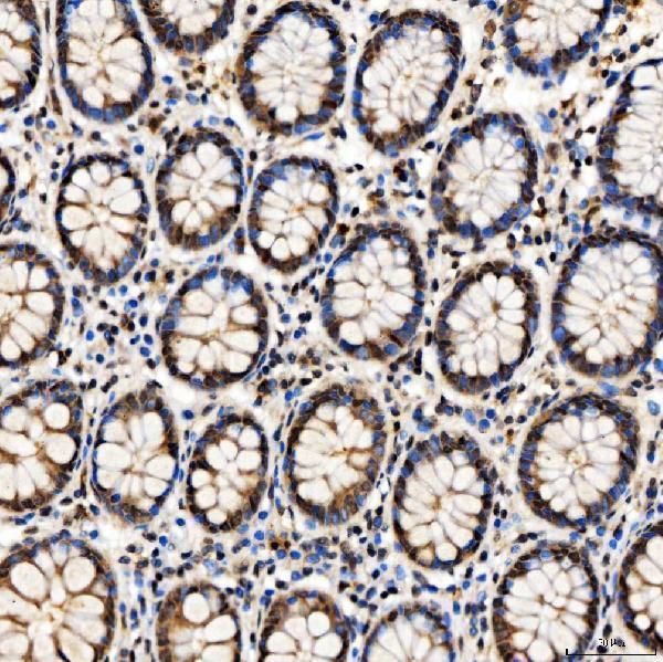 a01888 3 smarca2 primary antibodies ihc testing 4
