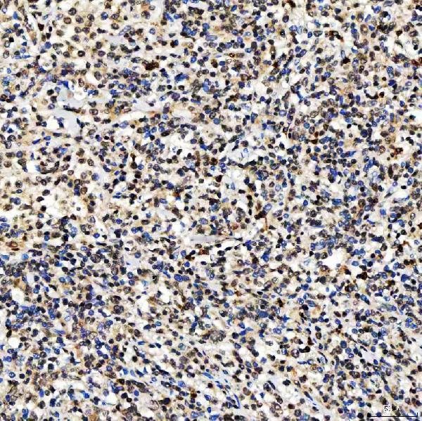 a01888 3 smarca2 primary antibodies ihc testing 5